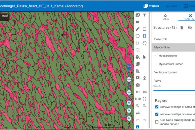 Fig. 14: Cardiac muscle in Transverse section Bar is 180 micrograms .