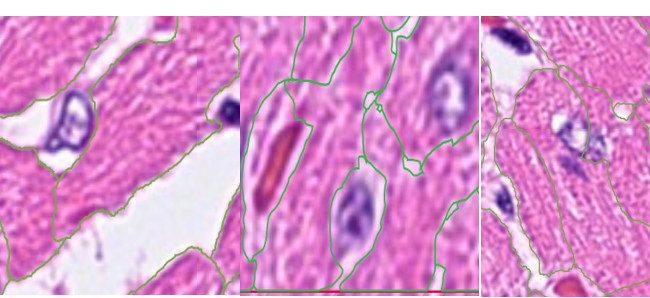 Fig. 12: Do not cut nuclei, a cell does not have 2 nuclei!
