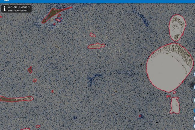 Fig. 2: Vessel part of liver model with low opacity 