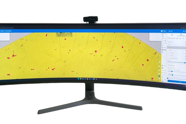 Fig. 1: Preview of vessels, non-vessels and cells detection in HSA Kit