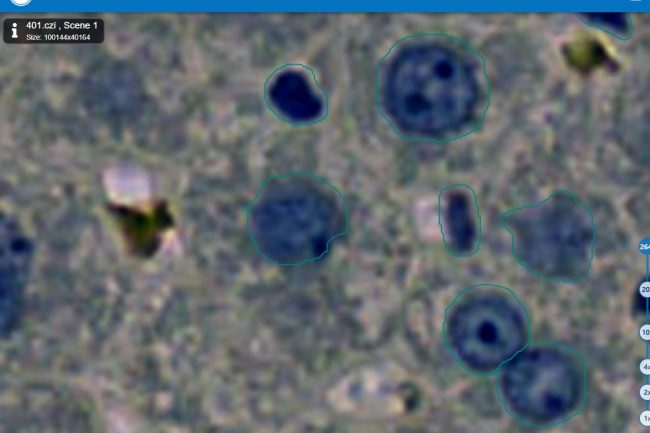 Fig. 4: Cells negative (blue, marked green) of liver model with low opacity 