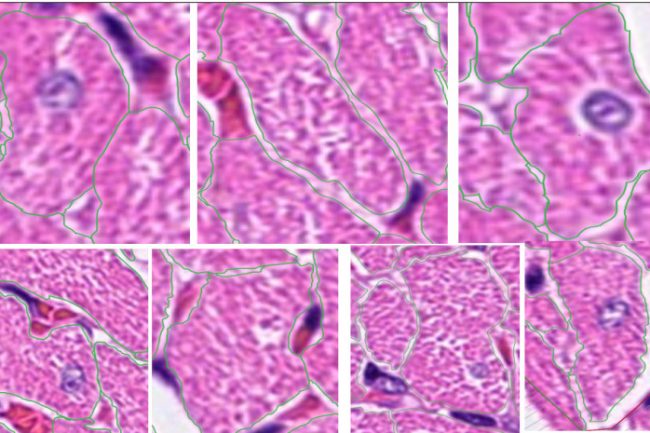 Fig. 10: Preview of annotating Cardiomyocyte project 