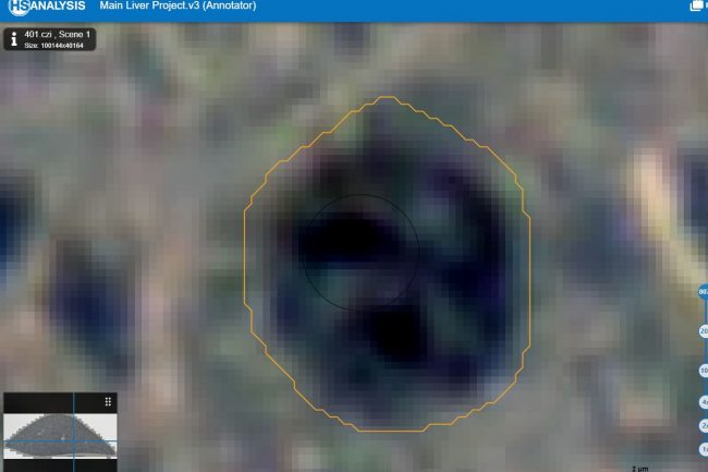 Fig. 8: Uncertain Cells (Between cell positive and cell negative, marked orange) of liver model with low opacity