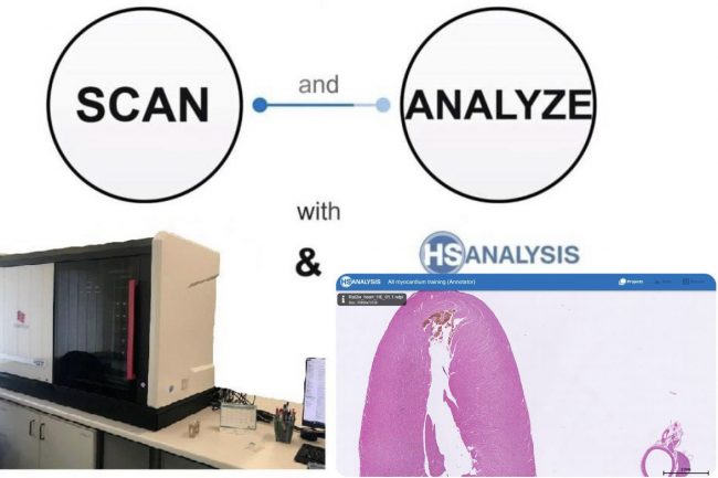 Fig. 7: Preview scanning and analyzing of HSA KIT
