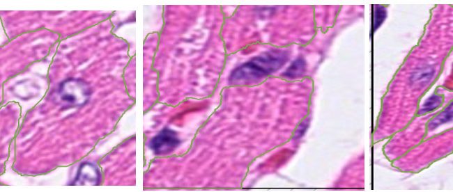 Fig. 11: Large light blue nuclei, which are usually white a bit from inside, must be located inside the cell.