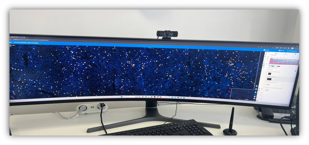 The HS Analysis software is quite useful in assisting medical practitioners in detecting diseases. It allows them to diagnose and assess numerous medical disorders by evaluating high-resolution images of tissues and organs.