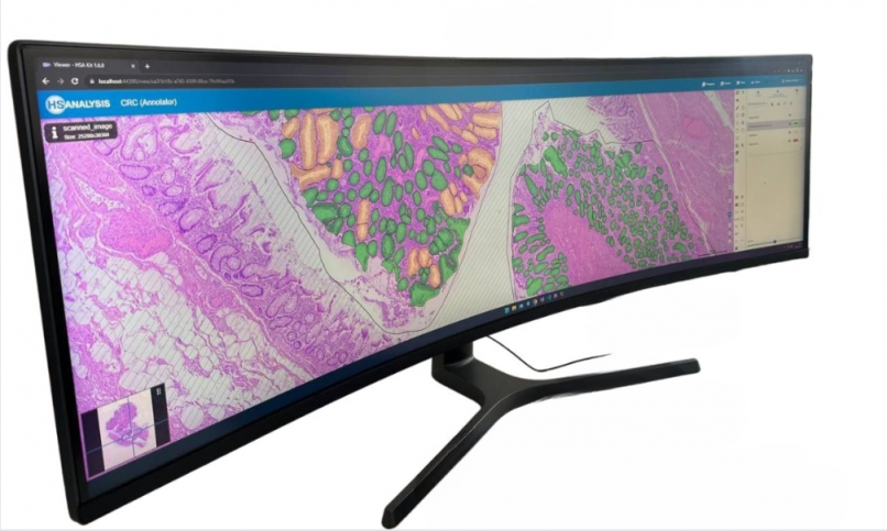 HS Analysis GmbH specializes in recognizing cells on the verge of developing cancer and malignancies. However, detection is insufficient without adequate data analysis. The HSA KIT program can extract data into Excel spreadsheets, allowing for complete result display via reports, graphs, and figures.