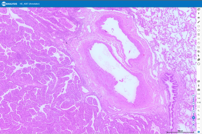 Hematoxylin and eosin staining enables the differentiation of cell types within tissue samples and visualization of cellular features and tissue structure.