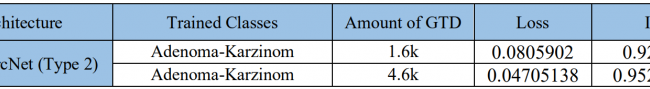 Loss and IoU results of trained models (Segmentation).