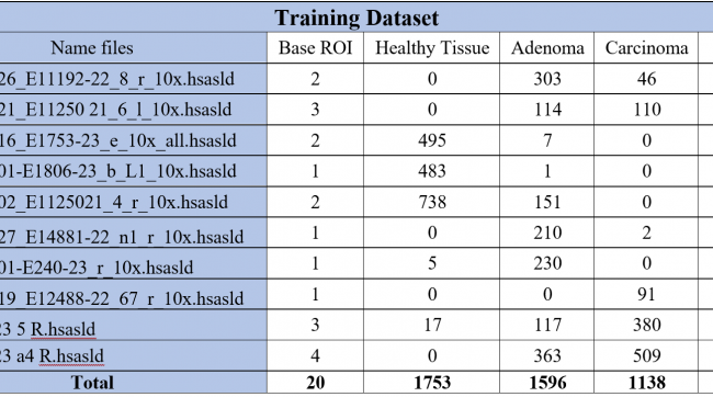4.3K GTDs were used as training dataset for CRC DL model