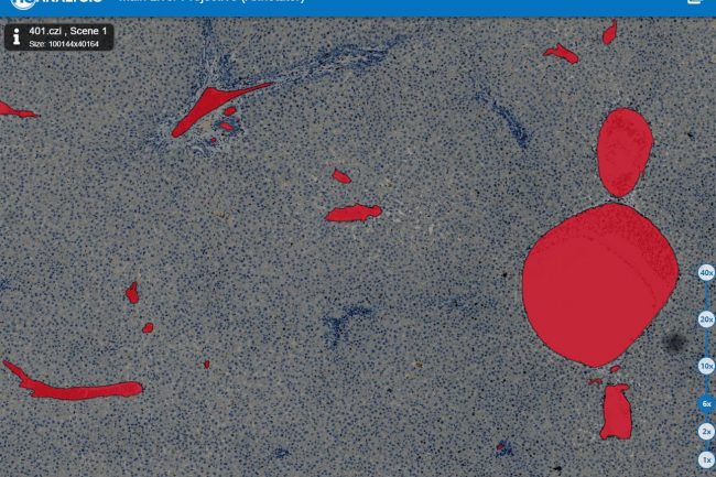 Fig. 3: Vessel part of liver model with high opacity 