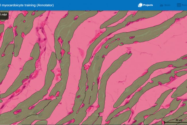 Fig. 15: Cardiac muscle in longitudinal section. Bar is 50 micrograms