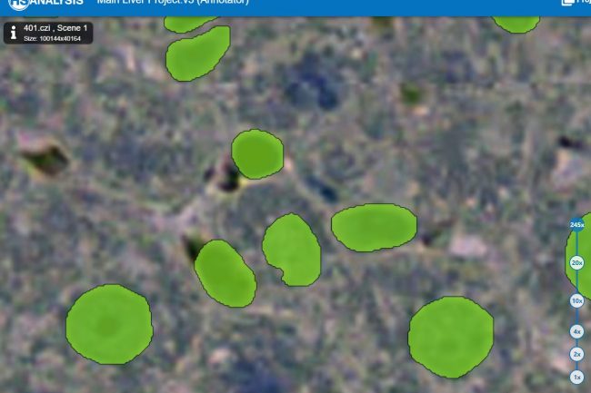Fig. 5: Cells negative (blue, marked green) of liver model with high opacity 