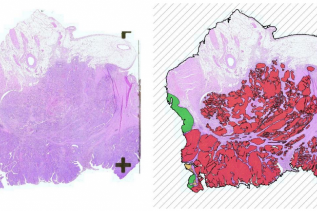Left is a tissue cut from colon without annotations, right is the same tissue cut with annotations