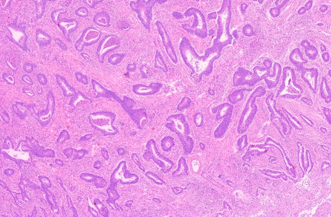 Abb. 4: HE gefärbter Drüsengewebeschnitt der Schleimhäute im HSA KIT