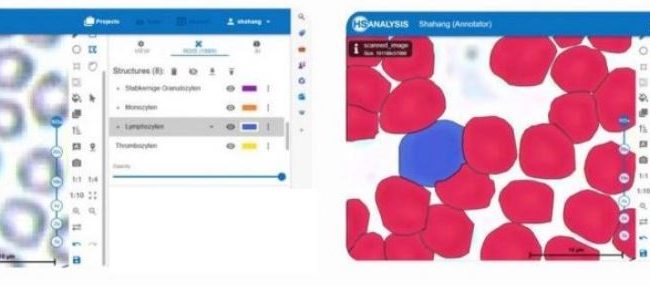 Left: Lymphocyte and Erythrocytes / Right: Lymphocyte and Erythrocytes detected by HyperHaemaNet Model