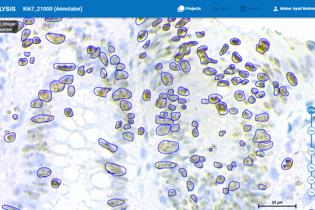 Here the infected cells are annotated by the annotator