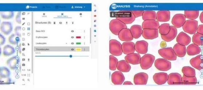 Left: Thrombocyte and Erythrocytes / Right: Thrombocyte and Erythrocytes detected by HyperHaemaNet Model