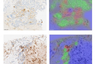 Use explainable AI to understand what lead to the decission of the AI