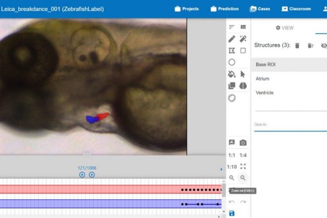 Our software allows us to annotate video files quickly through interpolation . By annotating your structure of choice (here heart) in two scenes the scenes in between will be annotated automatically by AI (dotts in the lower red and blue line indicate annotated scenes).