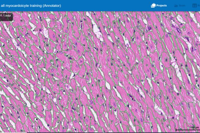 Fig. 13: Preview of annotating Cardiomyocyte project in HSA KIT