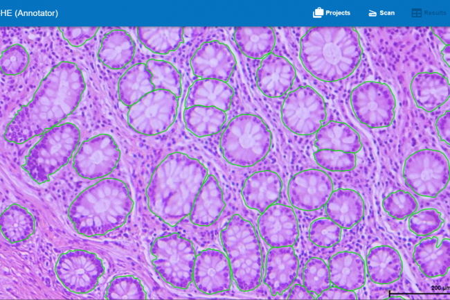 Abb. 1: Im HSA KIT detektierte Gesunde Drüsen (Grün umrandet)