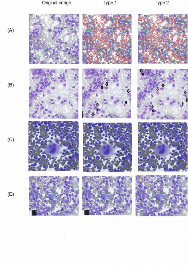 Visualization of the training results of both types of HyperCMLNet