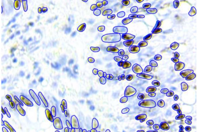 review around the cells with (blue and yellow colors without including the white area around the cells) which is of interest