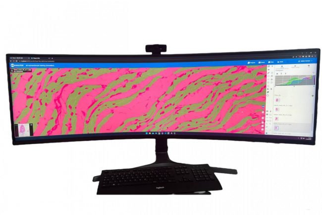 Fig. 2: Preview of Cardiomyocyte Base ROI in HSA KIT