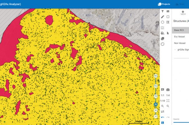 Zoomlevel: 40x; highest opacity