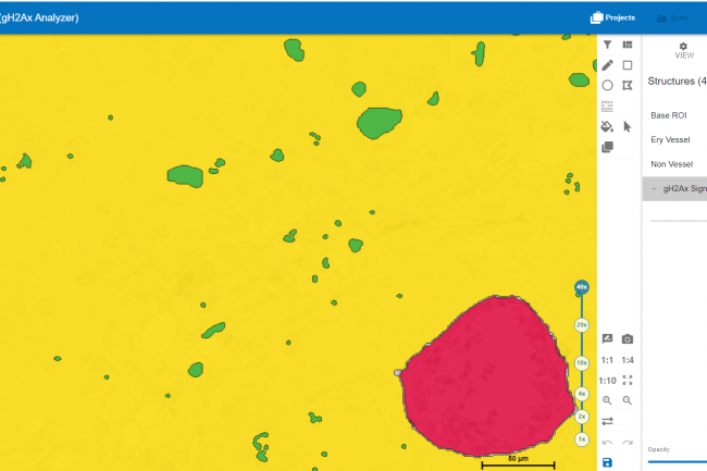 Zoomlevel 40x; highest opacity