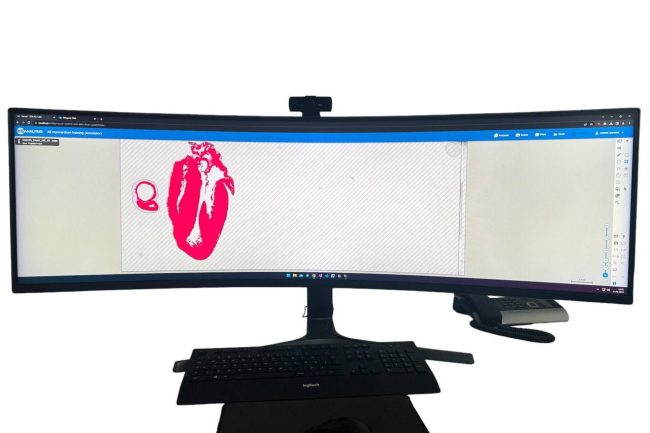 Fig. 3: Preview of Myocardium Base ROI in HSA KIT